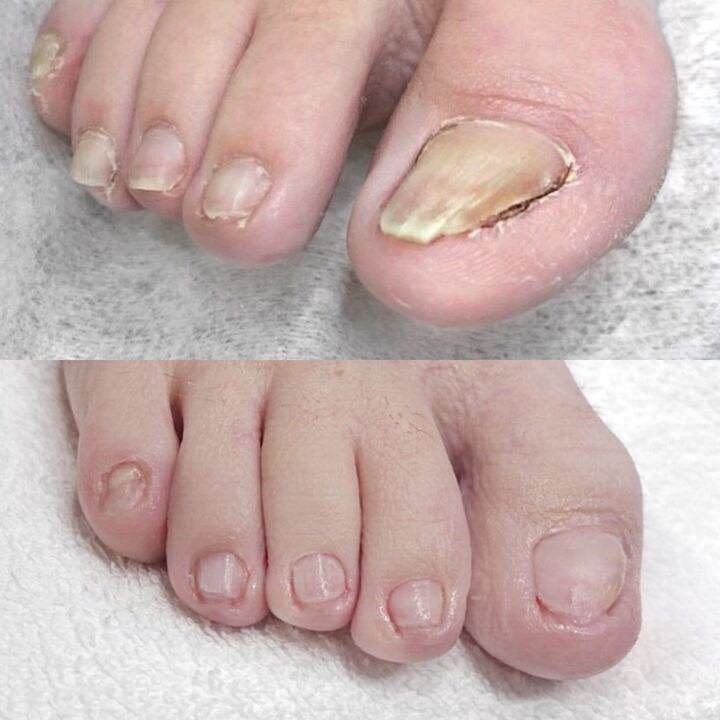 Comentarios sobre el uso de Keramin