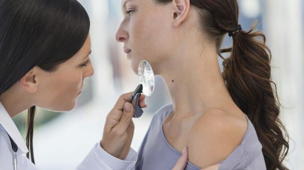 ¿Por qué aparecen papilomas en el cuello